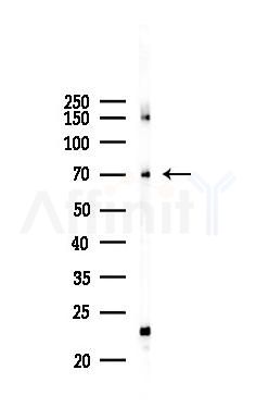UNC93B1 Antibody - Western blot analysis of lysates from 293 cells(UV 30min treatment), using UNC93B1 Antibody at 1/1000 dilution.