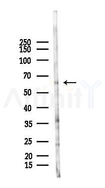ERVK-18 Antibody - Western blot analysis of lysates from HUVEC cells(LPS 4h treatment), using ERVK-18 Antibody at 1/1000 dilution.