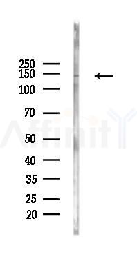 MYO1C Antibody - Western blot analysis of lysates from B16F10-LUC cells(LPS 4h treatment), using MYO1C Antibody at 1/1000 dilution.