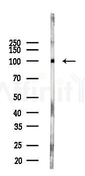 PPP6R3 Antibody - Western blot analysis of lysates from B16F10-LUC cells(LPS 4h treatment), using PPP6R3 Antibody at 1/1000 dilution.