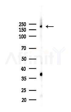 ARFGEF1 Antibody - Western blot analysis of lysates from K562 cells(heat-shock 45min treatment), using ARFGEF1 Antibody at 1/1000 dilution.