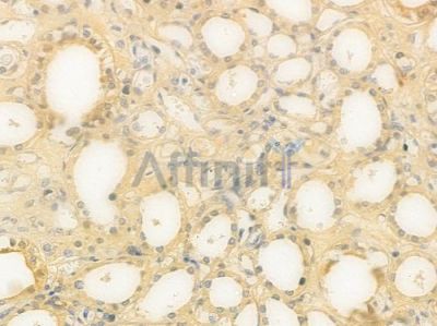 NAGLU Antibody - DF14652 at 1/100 staining human normal kidney tissue by IHC-P.