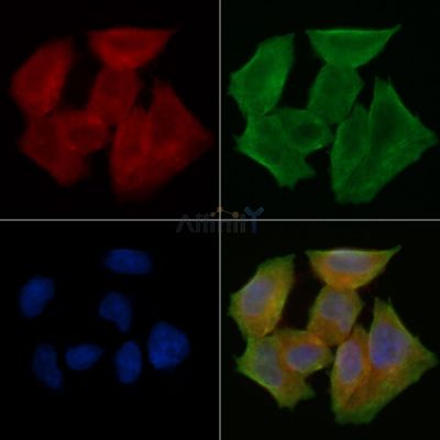 TRIP11 Antibody - DF14653 staining Hela cells(45min of heat-shock treatment) by IF/ICC.