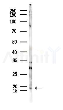 EMP3 Antibody - Western blot analysis of lysates from Rat liver, using EMP3 Antibody at 1/1000 dilution.