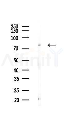 TRIM56 Antibody - Western blot analysis of lysates from B16F10-LUC cells(LPS 4h treatment), using TRIM56 Antibody at 1/1000 dilution.