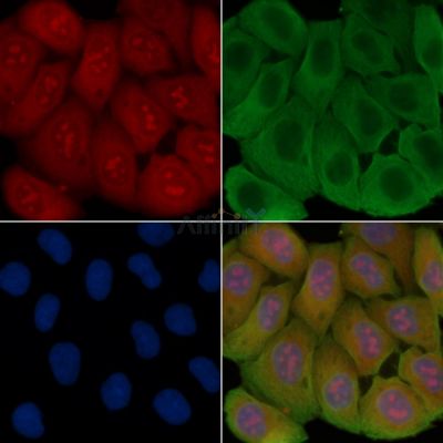GTF3C5 Antibody - DF14665 staining Hela cells(30min of UV treatment) by IF/ICC.