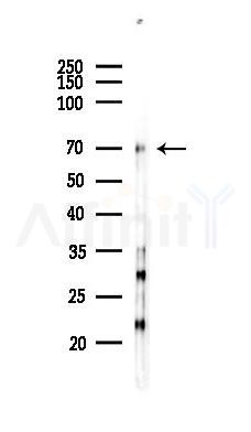 DNAAF1 Antibody - Western blot analysis of lysates from K562 cells(UV 30min treatment), using DNAAF1 Antibody at 1/1000 dilution.