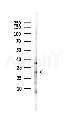TMEM163 Antibody - Western blot analysis of lysates from PC12 cells(LPS 4h treatment), using TMEM163 Antibody at 1/1000 dilution.