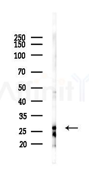 DERL3 Antibody - Western blot analysis of lysates from EC304 cells(starvation 24h treatment), using DERL3 Antibody at 1/1000 dilution.