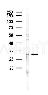 RNF170 Antibody - Western blot analysis of lysates from PC12 cells(LPS 4h treatment), using RNF170 Antibody at 1/1000 dilution.