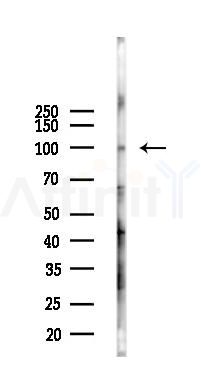 ANO3 Antibody - Western blot analysis of lysates from A2780 cells(LPS 4h treatment), using ANO3 Antibody at 1/1000 dilution.