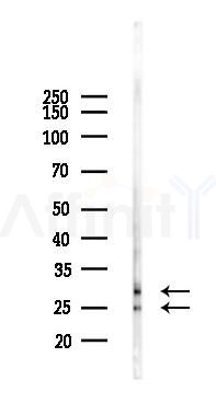 MTX2 Antibody - Western blot analysis of lysates from A2780 cells(LPS 4h treatment), using MTX2 Antibody at 1/1000 dilution.