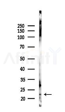 SSX6 Antibody - Western blot analysis of lysates from RAW264.