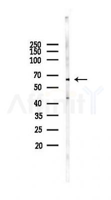 UGT2B15 Antibody - Western blot analysis of lysates from EC304 cells(starvation 24h treatment), using UGT2B15 Antibody at 1/1000 dilution.