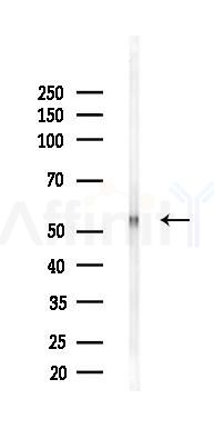 SLC41A1 Antibody - Western blot analysis of lysates from Rat liver, using SLC41A1 Antibody at 1/1000 dilution.