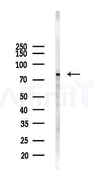 ADARB2 Antibody - Western blot analysis of lysates from A2780 cells(LPS 4h treatment), using ADARB2 Antibody at 1/1000 dilution.