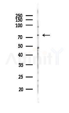 SLCO3A1 Antibody - Western blot analysis of lysates from K562 cells(UV 30min treatment), using SLCO3A1 Antibody at 1/1000 dilution.