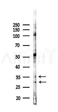 MOGAT2 Antibody - Western blot analysis of lysates from RAW264.