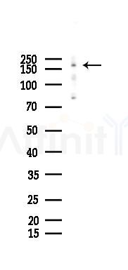 PHRF1 Antibody - Western blot analysis of lysates from HUVEC cells(LPS 4h treatment), using PHRF1 Antibody at 1/1000 dilution.