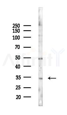 SERTAD2 Antibody - Western blot analysis of lysates from K562 cells(starvation 24h treatment), using SERTAD2 Antibody at 1/1000 dilution.
