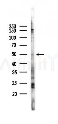 TRIML2 Antibody - Western blot analysis of lysates from PC12 cells(LPS 4h treatment), using TRIML2 Antibody at 1/1000 dilution.