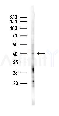 COQ2 Antibody - Western blot analysis of lysates from PC12 cells(LPS 4h treatment), using COQ2 Antibody at 1/1000 dilution.