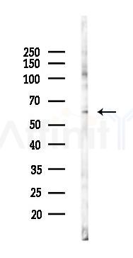 RNPC3 Antibody - Western blot analysis of lysates from K562 cells(starvation 24h treatment), using RNPC3 Antibody at 1/1000 dilution.