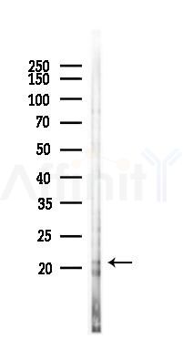 CRYGC Antibody - Western blot analysis of lysates from PC12 cells(LPS 4h treatment), using CRYGC Antibody at 1/1000 dilution.