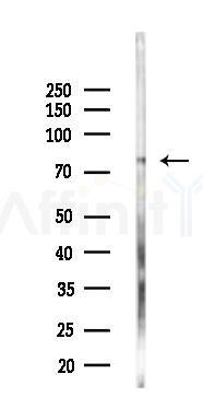 PARP12 Antibody - Western blot analysis of lysates from Rat liver, using PARP12 Antibody at 1/1000 dilution.