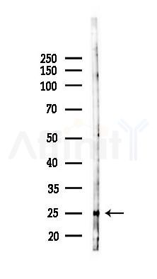 JCHAIN Antibody - Western blot analysis of lysates from RAW264.