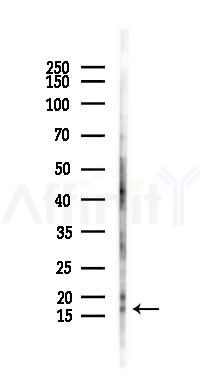 TSHB Antibody - Western blot analysis of lysates from HUVEC cells(LPS 4h treatment), using TSHB Antibody at 1/1000 dilution.