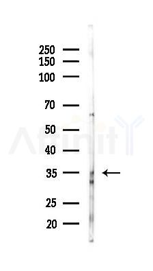 DERA Antibody - Western blot analysis of lysates from A2780 cells(LPS 4h treatment), using DERA Antibody at 1/1000 dilution.
