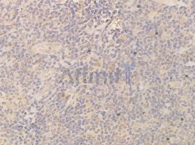 ZNF410 Antibody - DF14815 at 1/100 staining human normal tonsil tissue by IHC-P.
