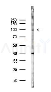 INTS6L Antibody - Western blot analysis of lysates from COLO205 cells(UV 30min treatment), using INTS6L Antibody at 1/1000 dilution.