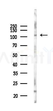 DSC2 Antibody - Western blot analysis of lysates from COLO205 cells(UV 30min treatment), using DSC2 Antibody at 1/1000 dilution.