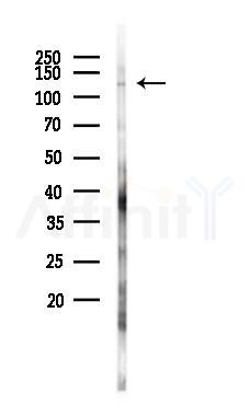 FBLN2 Antibody - Western blot analysis of lysates from PC12 cells(LPS 4h treatment), using FBLN2 Antibody at 1/1000 dilution.