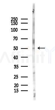 AP4M1 Antibody - Western blot analysis of lysates from HUVEC cells(LPS 4h treatment), using AP4M1 Antibody at 1/1000 dilution.