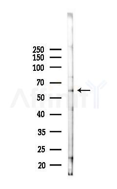 ENTPD6 Antibody - Western blot analysis of lysates from Mouse testis, using ENTPD6 Antibody at 1/1000 dilution.