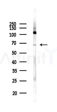 NME8 Antibody - Western blot analysis of lysates from COLO205 cells(UV 30min treatment), using NME8 Antibody at 1/1000 dilution.