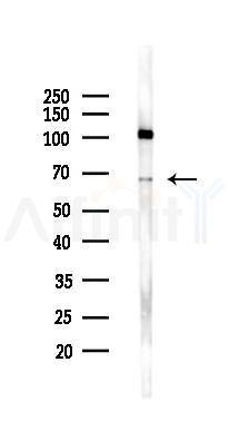 NME8 Antibody - Western blot analysis of lysates from K562 cells(UV 30min treatment), using NME8 Antibody at 1/1000 dilution.