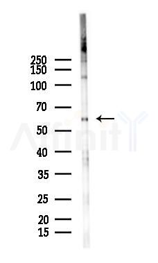 PLA2G3 Antibody - Western blot analysis of lysates from HUVEC cells(LPS 4h treatment), using PLA2G3 Antibody at 1/1000 dilution.