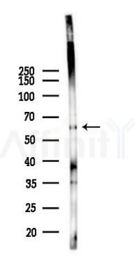PLA2G3 Antibody - Western blot analysis of lysates from Mouse lung, using PLA2G3 Antibody at 1/1000 dilution.