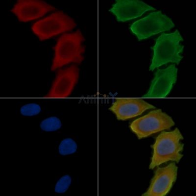 PTGFRN Antibody - DF14861 staining Hela cells(30min of UV treatment) by IF/ICC.