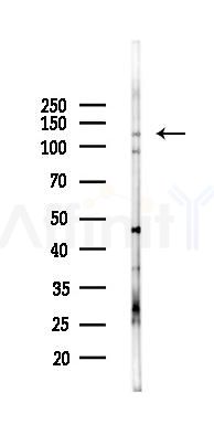IGSF3 Antibody - Western blot analysis of lysates from K562 cells(starvation 24h treatment), using IGSF3 Antibody at 1/1000 dilution.