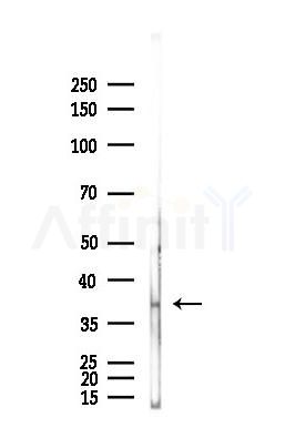 SLC25A33 Antibody - Western blot analysis of lysates from Rat brain, using SLC25A33 Antibody at 1/1000 dilution.