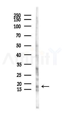 BCL2L15 Antibody - Western blot analysis of lysates from HUVEC cells(LPS 4h treatment), using BCL2L15 Antibody at 1/1000 dilution.
