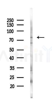 GOLGA6B Antibody - Western blot analysis of lysates from K562 cells(starvation 24h treatment), using GOLGA6B Antibody at 1/1000 dilution.