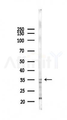 AEN Antibody - Western blot analysis of lysates from PC12 cells(LPS 4h treatment), using AEN Antibody at 1/1000 dilution.