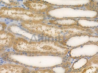 VPS28 Antibody - DF14882 at 1/100 staining human normal kidney tissue by IHC-P.