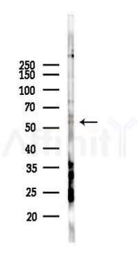 SNAP47 Antibody - Western blot analysis of lysates from PC12 cells(LPS 4h treatment), using SNAP47 Antibody at 1/1000 dilution.